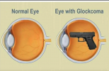 GlockComa.png