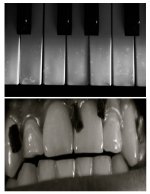 teeth-keys.jpg